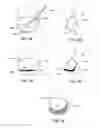 Fig. 06 - Systems and methods for mastopexy