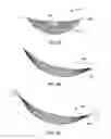 Fig. 11 - Systems and methods for mastopexy