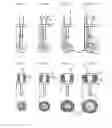 Fig. 07 - DEVICE FOR REVERSIBLY ATTACHING AN IMPLANT IN AN EYE
