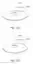 Fig. 12 - Masked intraocular implants and lenses