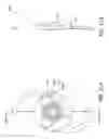 Fig. 34 - Masked intraocular implants and lenses