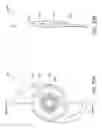 Fig. 36 - Masked intraocular implants and lenses