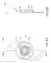 Fig. 37 - Masked intraocular implants and lenses