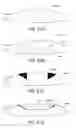 Fig. 40 - Masked intraocular implants and lenses