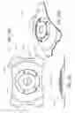 Fig. 51 - Masked intraocular implants and lenses