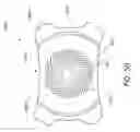 Fig. 64 - Masked intraocular implants and lenses