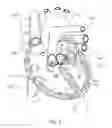 Fig. 06 - DEVICES AND METHODS FOR REDUCING CARDIAC VALVE REGURGITATION