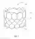 Fig. 10 - DEVICES AND METHODS FOR REDUCING CARDIAC VALVE REGURGITATION