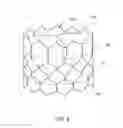 Fig. 11 - DEVICES AND METHODS FOR REDUCING CARDIAC VALVE REGURGITATION