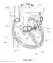 Fig. 17 - DEVICES AND METHODS FOR REDUCING CARDIAC VALVE REGURGITATION