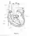 Fig. 19 - DEVICES AND METHODS FOR REDUCING CARDIAC VALVE REGURGITATION