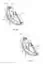Fig. 23 - DEVICES AND METHODS FOR REDUCING CARDIAC VALVE REGURGITATION