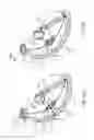 Fig. 27 - DEVICES AND METHODS FOR REDUCING CARDIAC VALVE REGURGITATION