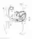 Fig. 30 - DEVICES AND METHODS FOR REDUCING CARDIAC VALVE REGURGITATION