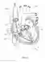Fig. 31 - DEVICES AND METHODS FOR REDUCING CARDIAC VALVE REGURGITATION