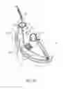 Fig. 34 - DEVICES AND METHODS FOR REDUCING CARDIAC VALVE REGURGITATION