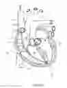Fig. 35 - DEVICES AND METHODS FOR REDUCING CARDIAC VALVE REGURGITATION