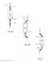 Fig. 43 - DEVICES AND METHODS FOR REDUCING CARDIAC VALVE REGURGITATION