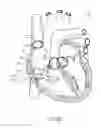 Fig. 45 - DEVICES AND METHODS FOR REDUCING CARDIAC VALVE REGURGITATION