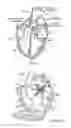 Fig. 02 - Prosthetic heart valve devices and associated systems and methods