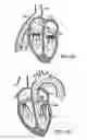 Fig. 06 - Prosthetic heart valve devices and associated systems and methods