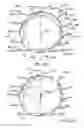 Fig. 10 - Prosthetic heart valve devices and associated systems and methods