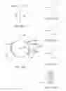 Fig. 12 - Prosthetic heart valve devices and associated systems and methods