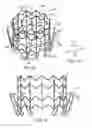 Fig. 29 - Prosthetic heart valve devices and associated systems and methods