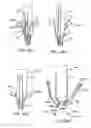 Fig. 32 - Prosthetic heart valve devices and associated systems and methods