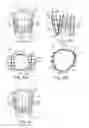 Fig. 47 - Prosthetic heart valve devices and associated systems and methods