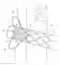 Fig. 01 - Vena-caval device