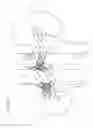 Fig. 07 - Vena-caval device