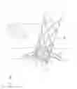 Fig. 08 - Vena-caval device