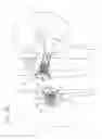 Fig. 10 - Vena-caval device