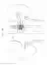 Fig. 11 - Vena-caval device