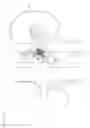 Fig. 15 - Vena-caval device