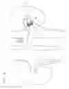Fig. 17 - Vena-caval device