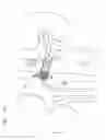 Fig. 21 - Vena-caval device