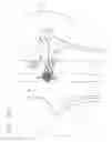 Fig. 22 - Vena-caval device