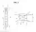 Fig. 03 - Valve prosthesis