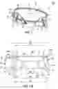 Fig. 02 - Mitral bileaflet valve