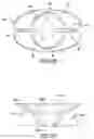 Fig. 07 - Mitral bileaflet valve