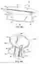 Fig. 08 - Mitral bileaflet valve