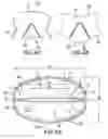 Fig. 10 - Mitral bileaflet valve