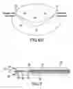 Fig. 13 - Mitral bileaflet valve