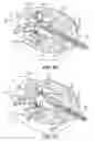 Fig. 15 - Mitral bileaflet valve