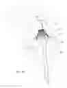 Fig. 05 - Mitral valve inversion prostheses