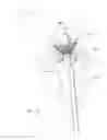 Fig. 07 - Mitral valve inversion prostheses