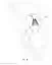Fig. 13 - Mitral valve inversion prostheses