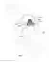 Fig. 14 - Mitral valve inversion prostheses